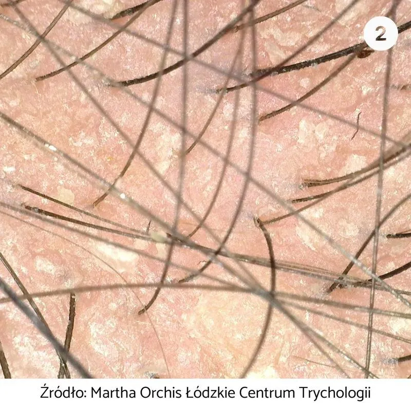 Na własnej skórze – odkryj fascynujące tajemnice wielkiego narządu w małej książce